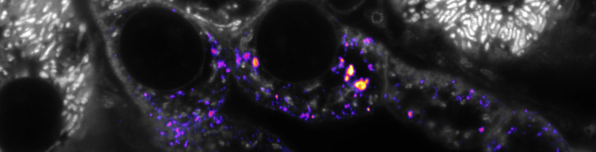Rottenyre-opsamlingskanal farvet for AQP2 og totalt protein